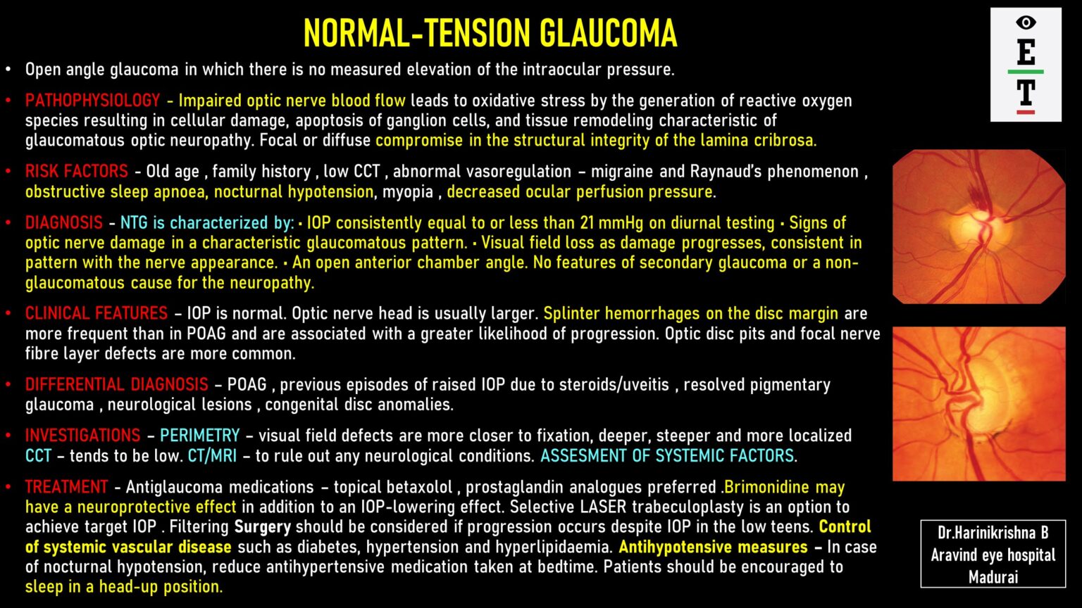 Normal Tension Glaucoma EyeToday